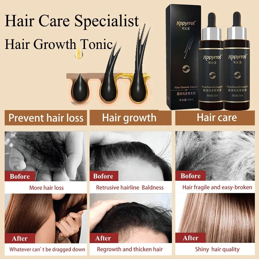 Hair Root Eyelash Growth Liquid Hair Growth Hair Renewal Liquid - Beuti-Ful