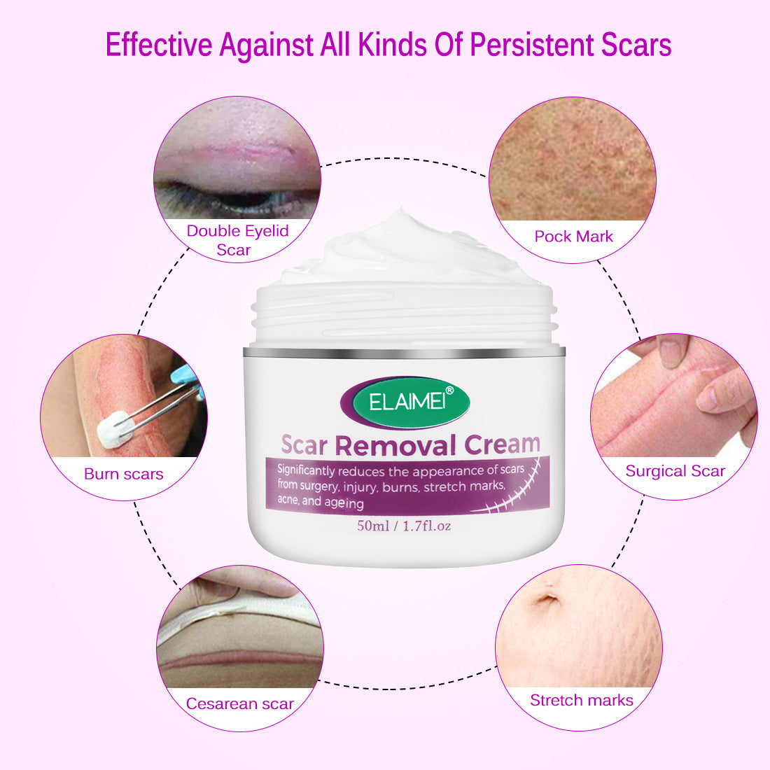 Skin Rebound Scarless Cream Scar Removal Cream Face Cream For Face Acne Scar Stretch Marks Skin Repair Face Cream - Beuti-Ful