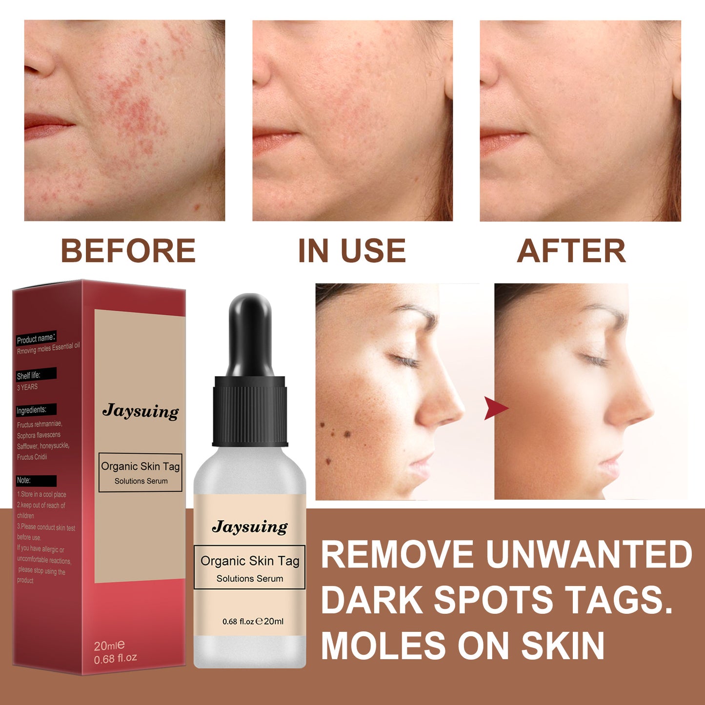 Anti-mole Potion Repair Smooth Skin Wart Care