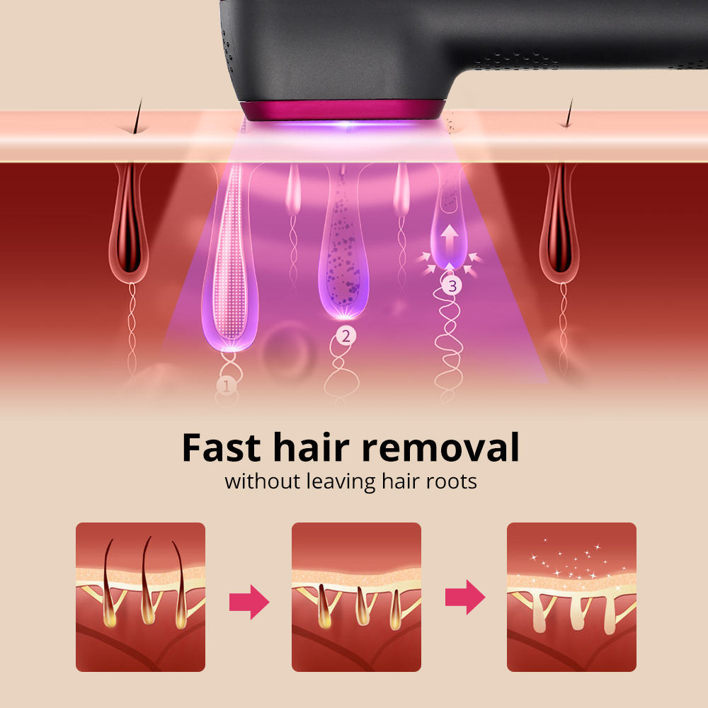 1PCS Laser Hair Removal For Women And Man 100,000 Flashes IPL Painless Laser Hair Removal - Beuti-Ful