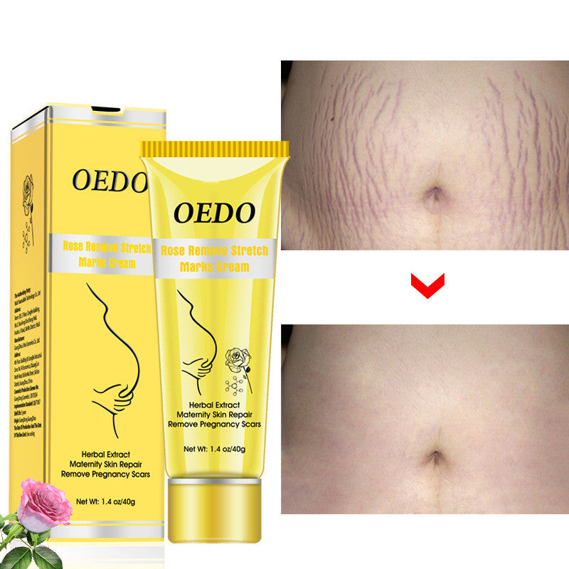 Rose Stretch Mark Removal Cream Anti-Wrinkle - Beuti-Ful