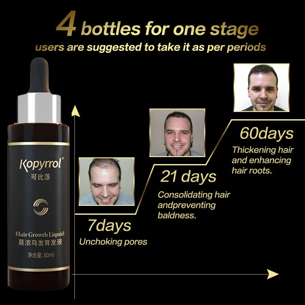 Hair Root Eyelash Growth Liquid Hair Growth Hair Renewal Liquid - Beuti-Ful