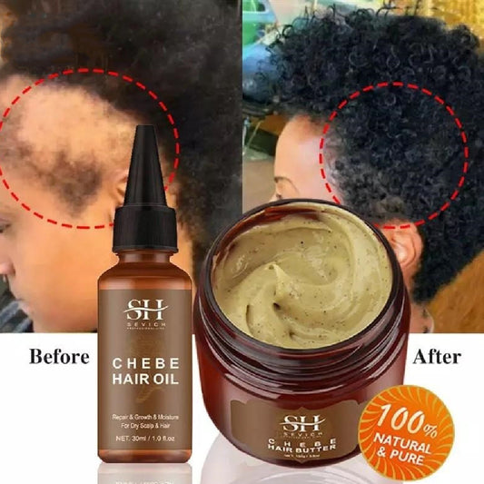 Fast Growth Traction Alopecia Chebe Hair Mask - Beuti-Ful