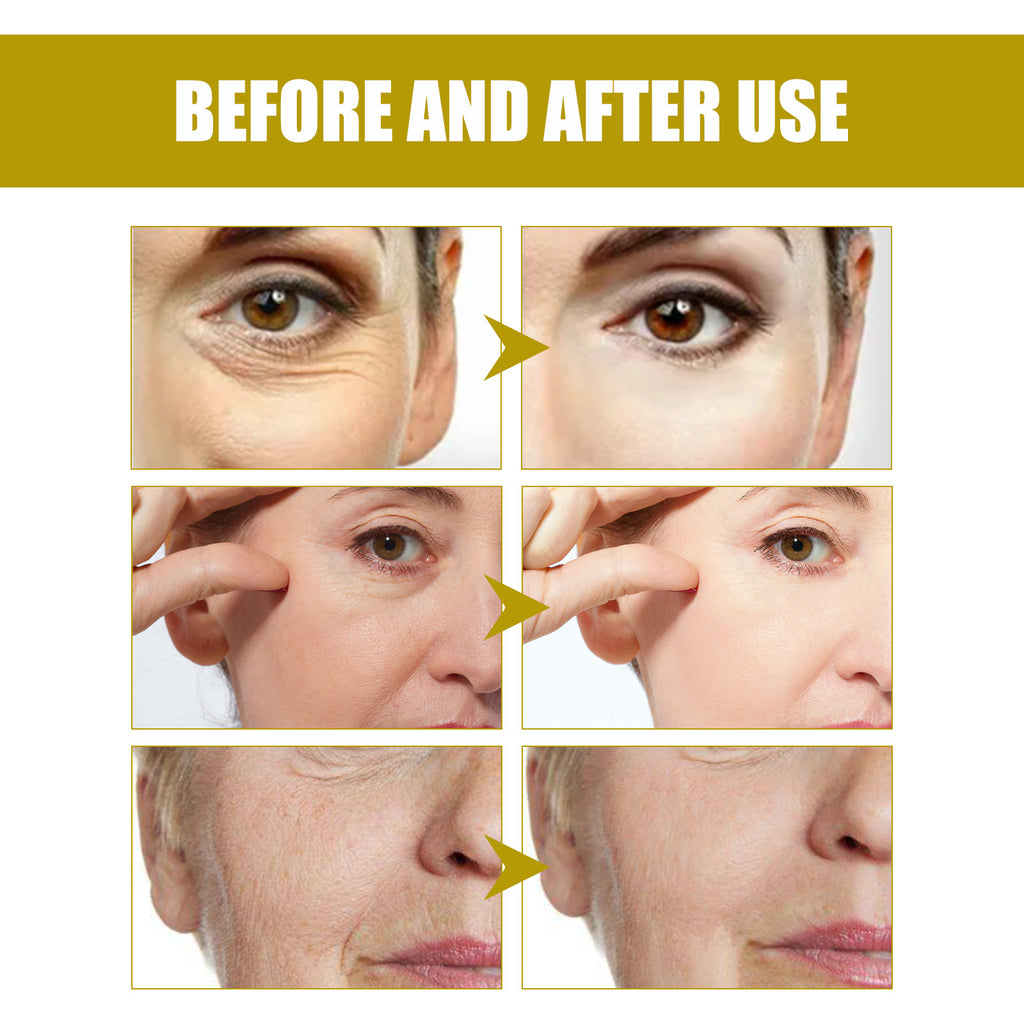 Anti-wrinkle Moisturizing Cream - Beuti-Ful