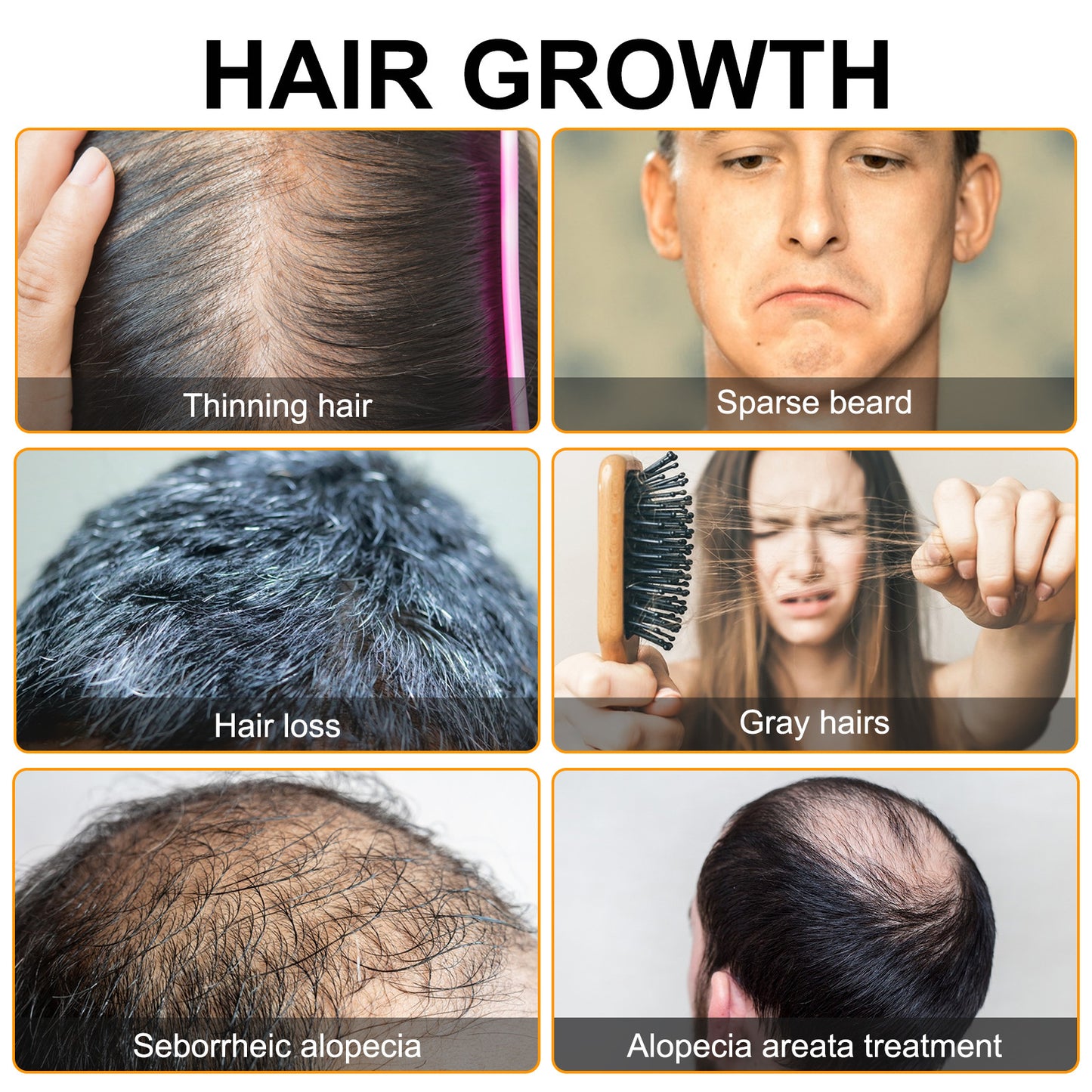 Hair Growth Moisturizing The Scalp And Preventing Hair Loss