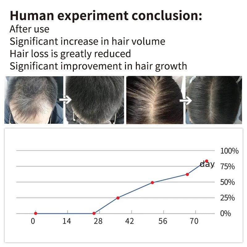 Hair Root Eyelash Growth Liquid Hair Growth Hair Renewal Liquid - Beuti-Ful