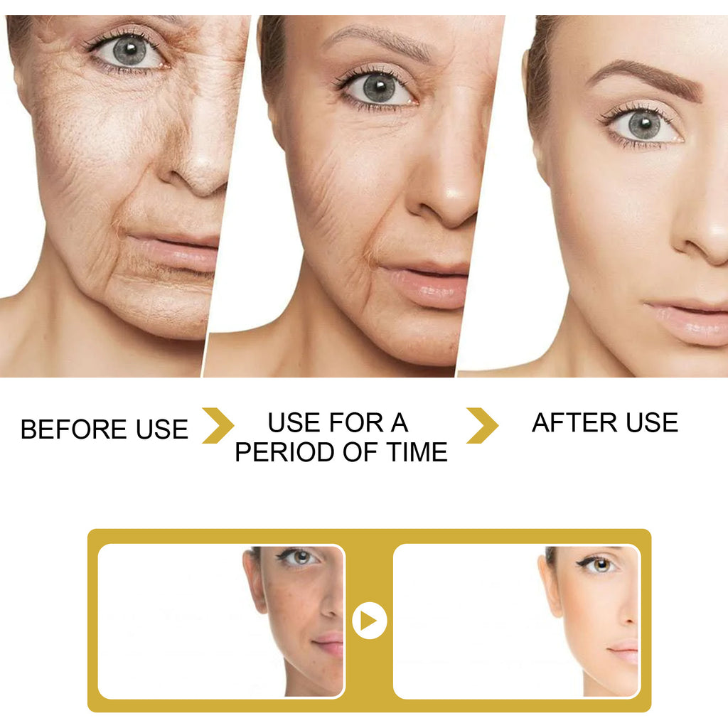 Anti-wrinkle Moisturizing Cream - Beuti-Ful